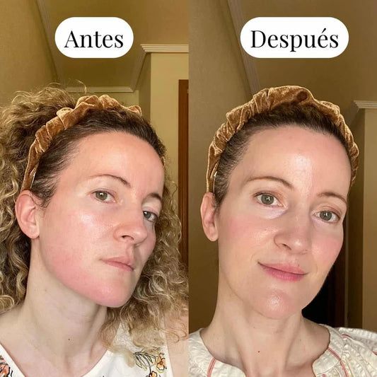 #1 Hidratante Para Piel Sensible 50 ml.